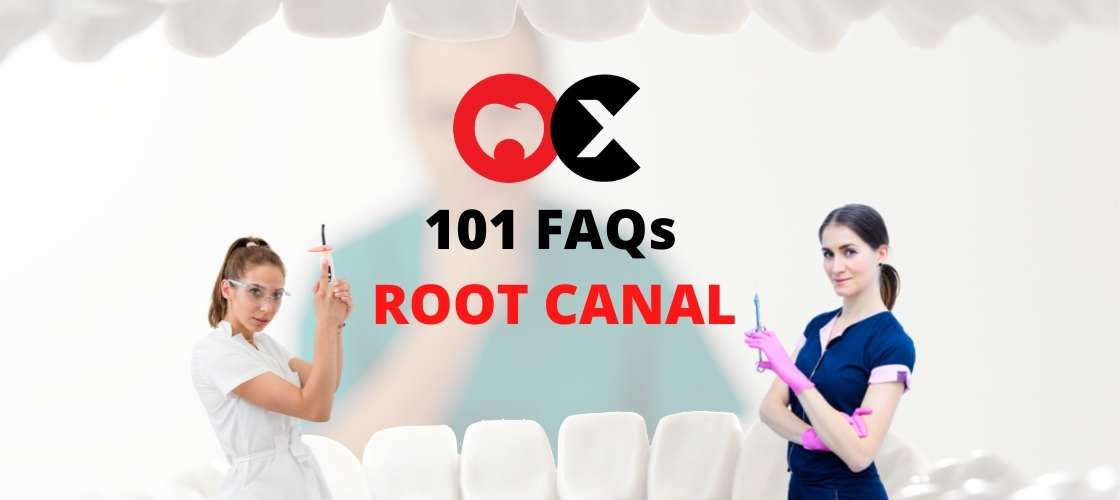 All About Root Canal Treatment 101 FAQs